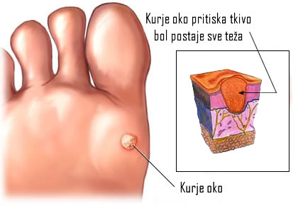 kurje oko